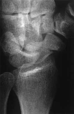 Trauma 2026 MCQs: Board Review Questions & Answers (Part 4) - Figure 9