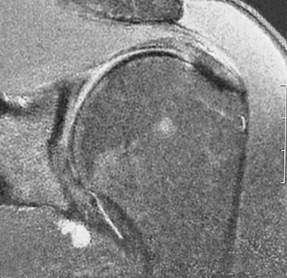 Upper Extremity 2005 Practice Questions: Set 1 (Solved) - Figure 19