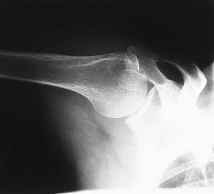 Upper Extremity 2005 Practice Questions: Set 1 (Solved) - Figure 2