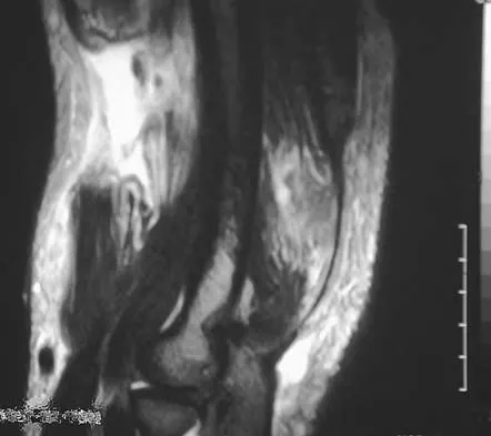 Upper Extremity 2005 Practice Questions: Set 1 (Solved) - Figure 21