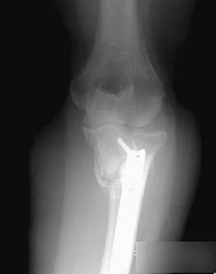 Upper Extremity 2005 Practice Questions: Set 1 (Solved) - Figure 25