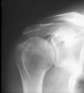 Upper Extremity 2005 Practice Questions: Set 1 (Solved) - Figure 28