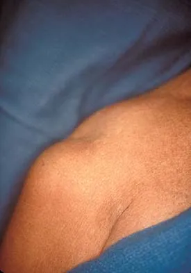 Upper Extremity 2005 Practice Questions: Set 1 (Solved) - Figure 29