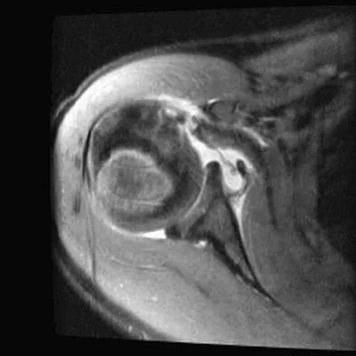 Upper Extremity 2005 Practice Questions: Set 1 (Solved) - Figure 9