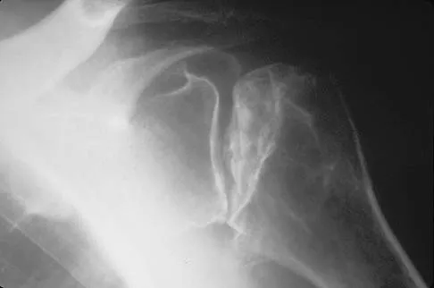 Upper Extremity Board Review 2005: High-Yield MCQs (Set 2) - Figure 20