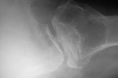 Upper Extremity Board Review 2005: High-Yield MCQs (Set 2) - Figure 21