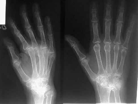 Upper Extremity Board Review 2005: High-Yield MCQs (Set 2) - Figure 27
