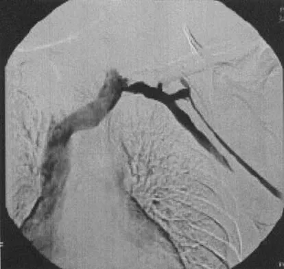 Upper Extremity Board Review 2005: High-Yield MCQs (Set 2) - Figure 4