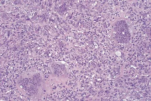Upper Extremity 2005 Practice Questions: Set 3 (Solved) - Figure 14