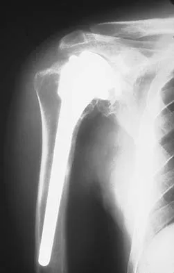 Upper Extremity 2005 Practice Questions: Set 3 (Solved) - Figure 17
