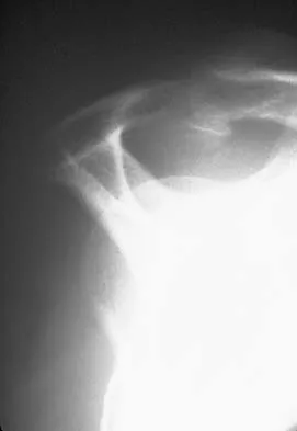 Upper Extremity 2005 Practice Questions: Set 3 (Solved) - Figure 4