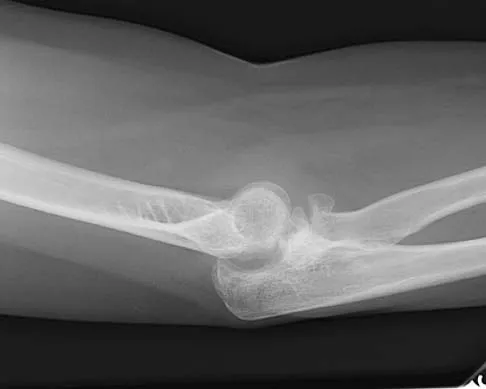 Upper Extremity 2005 Practice Questions: Set 3 (Solved) - Figure 9