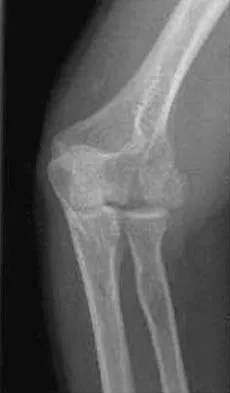 Upper Extremity Board Review 2005: High-Yield MCQs (Set 4) - Figure 17