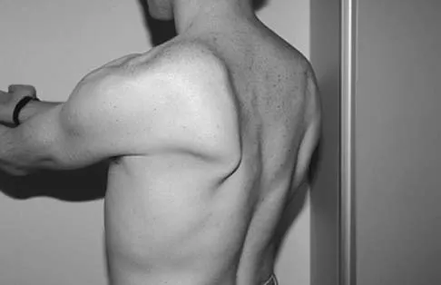 Upper Extremity Board Review 2005: High-Yield MCQs (Set 4) - Figure 5