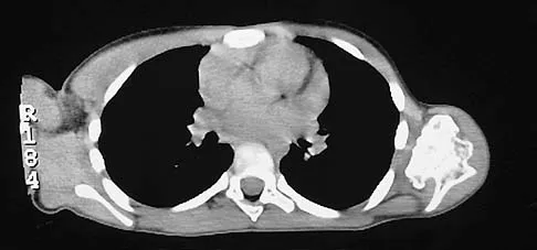 Upper Extremity Board Review 2005: High-Yield MCQs (Set 4) - Figure 7