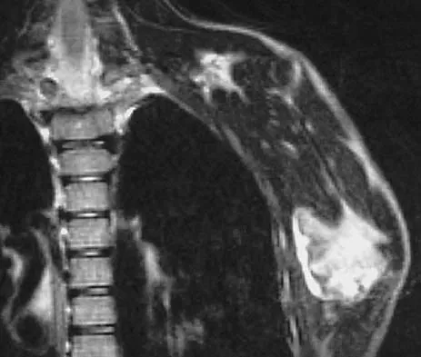 Upper Extremity Board Review 2005: High-Yield MCQs (Set 4) - Figure 8