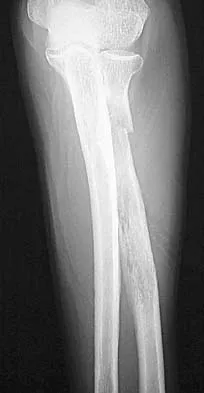 Upper Extremity Board Review 2005: High-Yield MCQs (Set 4) - Figure 9