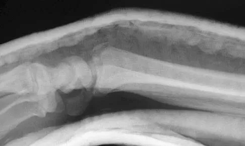 Upper Extremity 2005 Practice Questions: Set 5 (Solved) - Figure 10