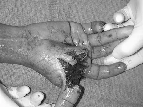 Upper Extremity 2005 Practice Questions: Set 5 (Solved) - Figure 16