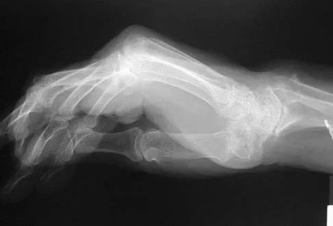 Upper Extremity 2005 Practice Questions: Set 5 (Solved) - Figure 5