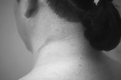 Upper Extremity 2008 Practice Questions: Set 1 (Solved) - Figure 14