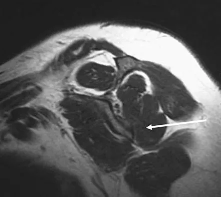 Upper Extremity 2008 Practice Questions: Set 1 (Solved) - Figure 15