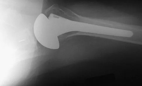 Upper Extremity 2008 Practice Questions: Set 1 (Solved) - Figure 16