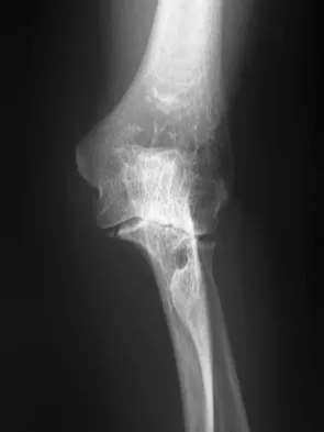 Upper Extremity 2008 Practice Questions: Set 1 (Solved) - Figure 18