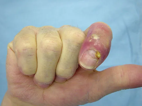 Upper Extremity 2008 Practice Questions: Set 1 (Solved) - Figure 19