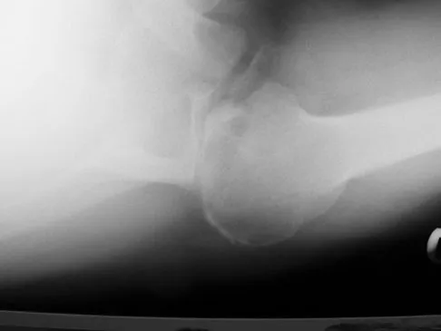 Upper Extremity 2008 Practice Questions: Set 1 (Solved) - Figure 2