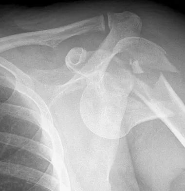 Upper Extremity 2008 Practice Questions: Set 1 (Solved) - Figure 24