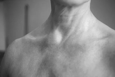 Upper Extremity 2008 Practice Questions: Set 1 (Solved) - Figure 25