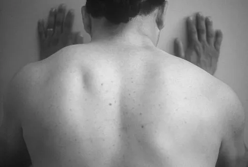 Upper Extremity 2008 Practice Questions: Set 1 (Solved) - Figure 29