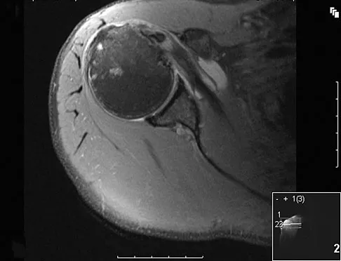Upper Extremity 2008 Practice Questions: Set 1 (Solved) - Figure 6