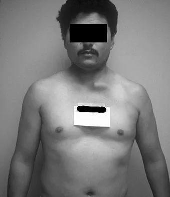 Upper Extremity Board Review 2008: High-Yield MCQs (Set 2) - Figure 21