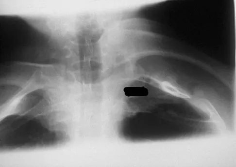 Upper Extremity Board Review 2008: High-Yield MCQs (Set 2) - Figure 22