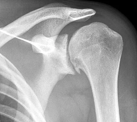 Upper Extremity Board Review 2008: High-Yield MCQs (Set 2) - Figure 24