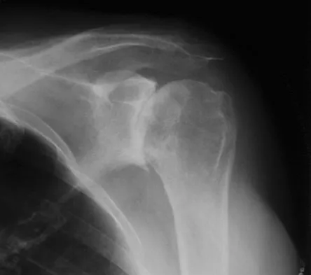 Upper Extremity Board Review 2008: High-Yield MCQs (Set 2) - Figure 31