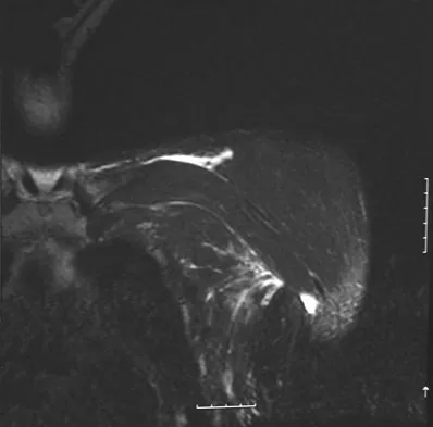 Upper Extremity Board Review 2008: High-Yield MCQs (Set 2) - Figure 7