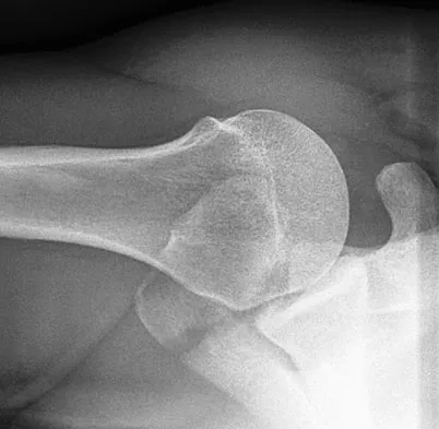 Upper Extremity 2008 Practice Questions: Set 3 (Solved) - Figure 1