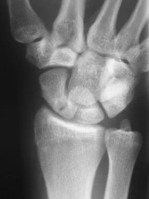 Upper Extremity 2008 Practice Questions: Set 3 (Solved) - Figure 13