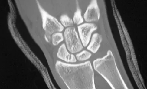 Upper Extremity 2008 Practice Questions: Set 3 (Solved) - Figure 14