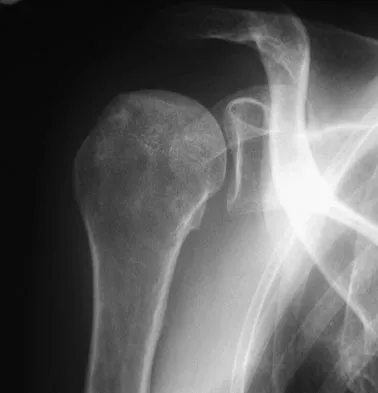 Upper Extremity 2008 Practice Questions: Set 3 (Solved) - Figure 16