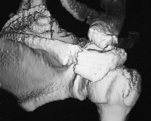 Upper Extremity 2008 Practice Questions: Set 3 (Solved) - Figure 2