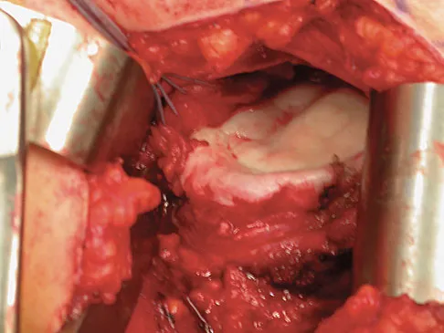 Upper Extremity 2008 Practice Questions: Set 3 (Solved) - Figure 20