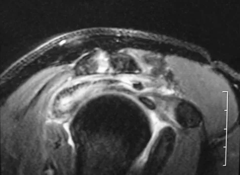 Upper Extremity 2008 Practice Questions: Set 3 (Solved) - Figure 25