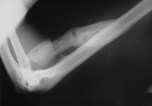 Upper Extremity 2008 Practice Questions: Set 3 (Solved) - Figure 27