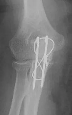 Upper Extremity 2008 Practice Questions: Set 3 (Solved) - Figure 7