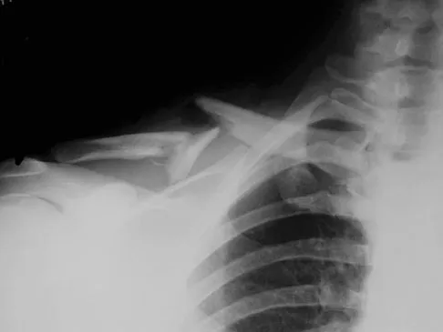 Upper Extremity 2008 Practice Questions: Set 3 (Solved) - Figure 8