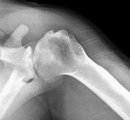 Upper Extremity Board Review 2008: High-Yield MCQs (Set 4) - Figure 13